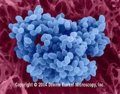 (3) 장알균 (Enterococcus) 통성혐기성, 카탈라아제 (catalase) 음성 산소가필요하지않으나산소가풍부한환경에서생존이가능하고 병원성없음 건조, 고온,
