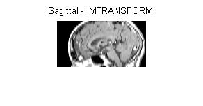 MRI 영상분석의예 >> load mri >> D = squeeze(d); >> size(d) 단층영상을열