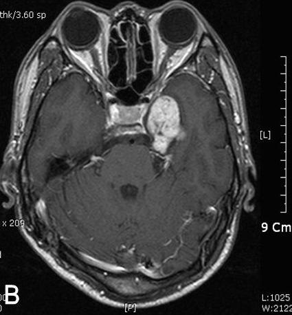 A B Fig. 4. Histopathologic findings.