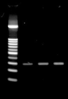 - Korean Journal of Medicine : Vol. 69, No. 6, 2005 - Figure 5. IL-8 elaboration by RV14 &/or CSE-stimulated BEAS-2B cells. Quantification of the IL-8 in BEAS-2B cell supernatants.