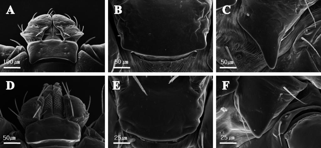 Scanning electron microscope observation of nymph stage (A-C) and larva stage (D-F).