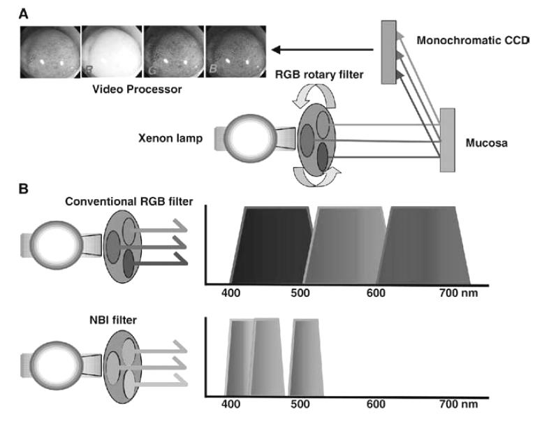 장재영 : 확대와색조변화를이용한내시경진단 - 상부내시경에서 NBI 의활용 Fig. 1. Conventional medical video endoscope system with the RGB sequential illumination method and the NBI system. 적진단을시각적으로가능하게한검사법이다.