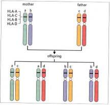 3 (MHC) (donor) (recipient) 30 ( ), (major histocompatibility antigens) (minor