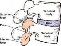 고리 척추몸체사이에는디스크라는 각각의척추에는척추연결 (the pars 라고불리는연결고리가있는데이는척추의위와아래를이어주는 역할을합니다.