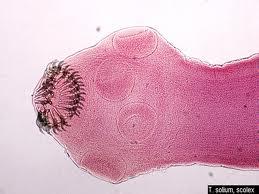 2) 유구조충 (Taenia solium, pork tape worm) =