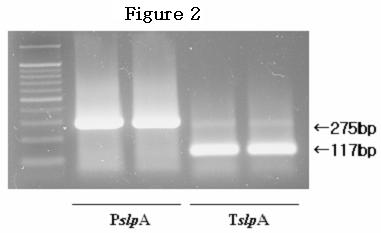 Fig. 3. Agarose gel electrophoresis of polymerase chain reaction -amplified PslpA (275bp)and TslpA (117bp) band.