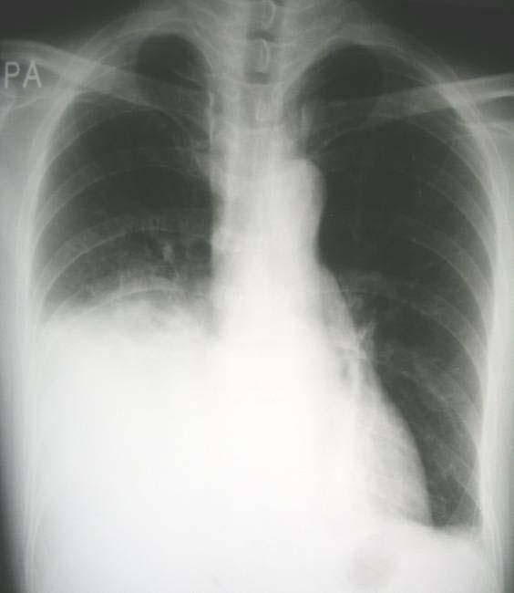 Tuberculosis and Respiratory Diseases Vol. 57. No. 6, Dec, 2004 a Figure 2.