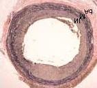 thalidomide-treated (F, H) rats. Note that neointimal growth was significantly inhibited in the thalidomide-treated rats.