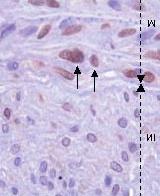 Uninjured Injured day 3 Injured day 14 C E 50 bfgf labeling (%) 40 30 20 10 00 Day 3 Day 14 B D F G Fig. 4. Comparison of bfgf staining in the arterial wall.