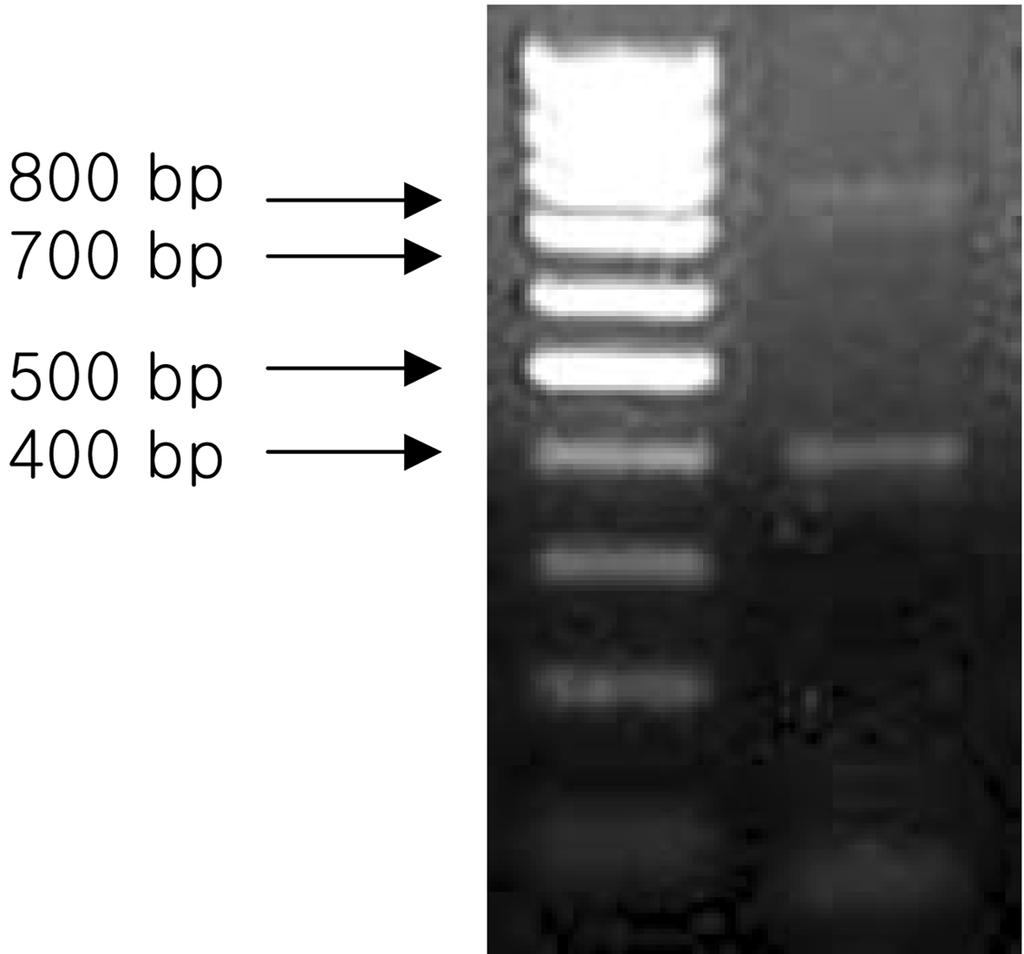 Vol. 41, No. 2 V. ichthyoenteri species-specfic primer 개발 119 Fig. 1. Random amplification of polymorphic DNA fragment patterns of V.