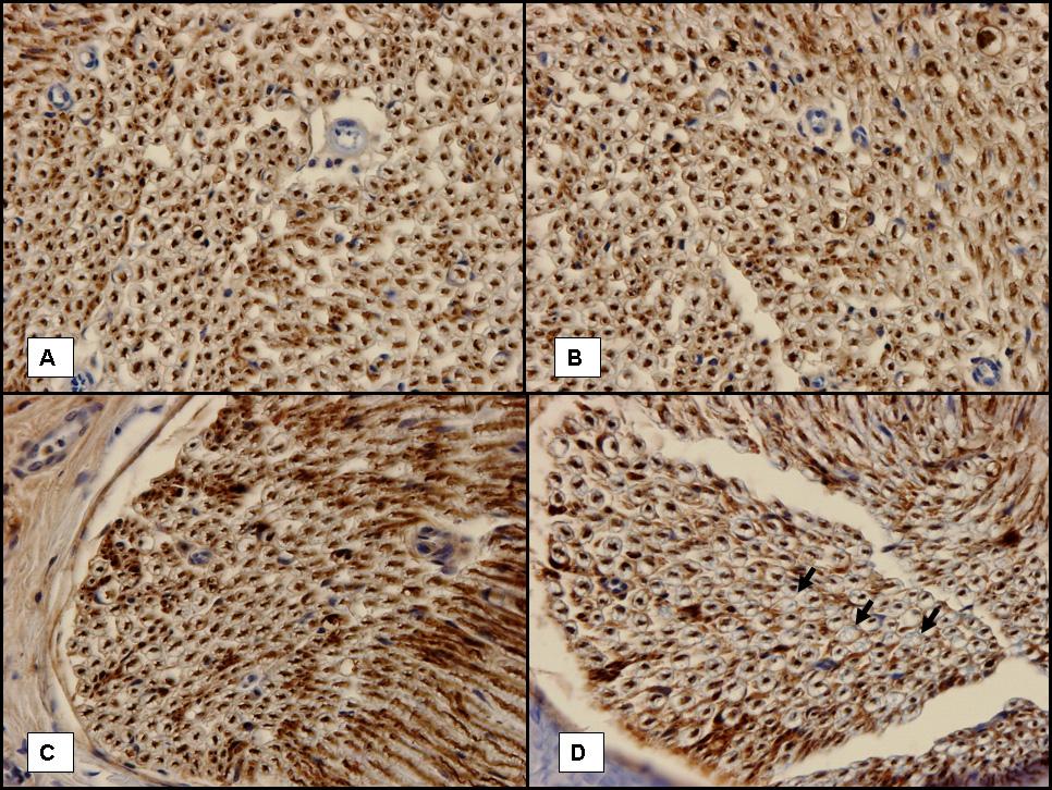 Figure 16. Immunohistochemical staining for neurofilament in rat sciatic nerves at 36 hours after compression injury.