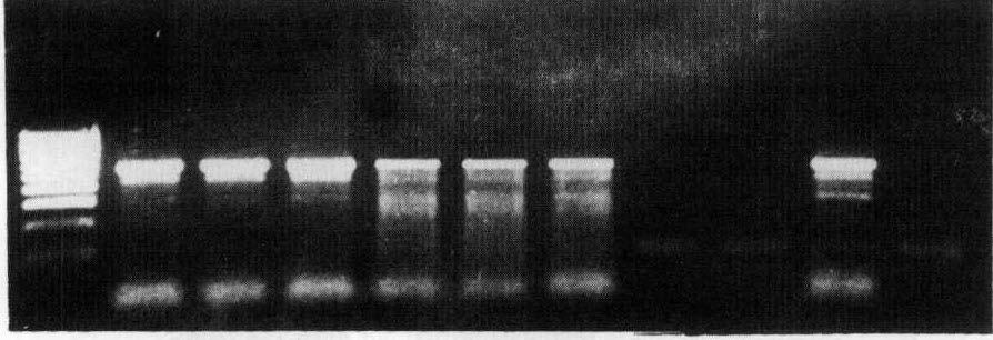 aeruginosa) M 1 2 3 4 5 6 7 8 9 10 372 률 Fig 2. Agarose gel electrophoreis of amplified 372-bp DNA fragments uf the fema genes of S. aureus isolates by PCR.