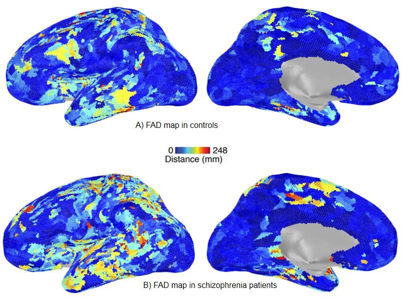 Figure 2. FAD maps in controls and schizophrenia patients.