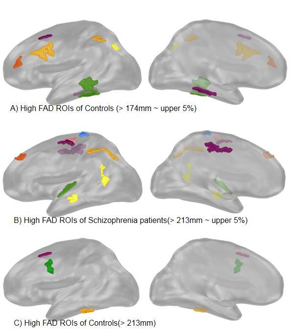 Figure 5. Clusters of upper 5% of FAD in normal control and schizophrenia.
