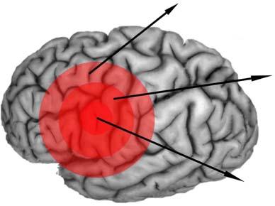 J Neurocrit Care 2008;1:1-11 에따르면 2020년에이르면뇌졸중은관상동맥질환과함께건강한삶을저해하는 (loss of healthy life year) 가장중요한원인이될것이다. 4 통계청과질병관리본부의보고서를이용하여미래의우리나라뇌졸중발생건수를추정하면 2030년에는 35만건으로증가될것으로추정되며이는인구의빠른노령화에의할것으로여겨진다.