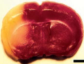 B: 16 hours after ischemia without any treatment, the core extends widely into cortical areas meaning that the penumbra has been recruited. A FIGURE 3.