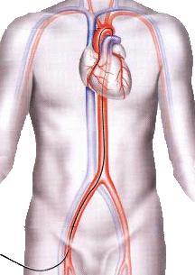 Catheter 개발사 )