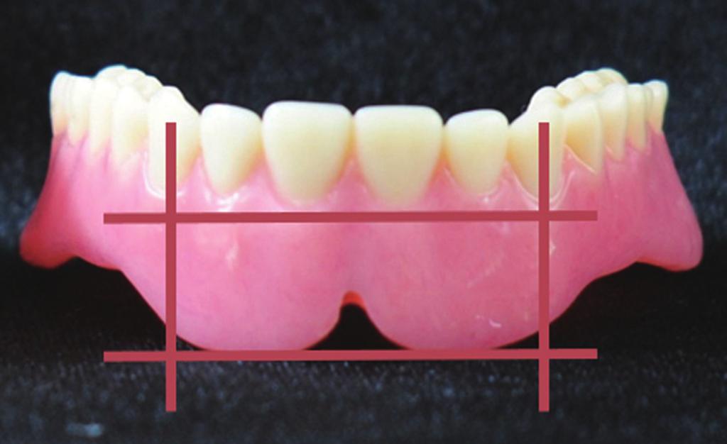 Prevention of Candida albicans infection in dental polishing lathe by chlorhexidine 양기 (WIG01105, Daihan Scientific Co., Seoul, Korea) 에서배양하였다. 2. 의치표면균사막형성 C.