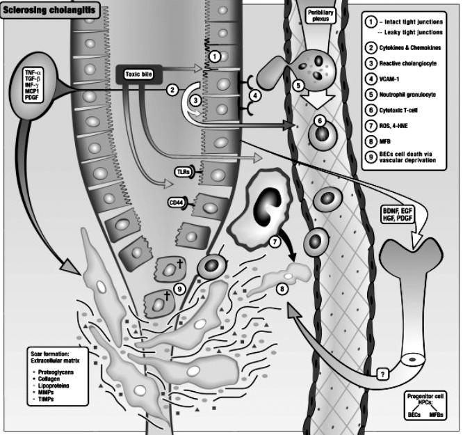 134 2007 년도대한췌담도학회추계학술대회 Fig. 2. Model of the development of primary sclerosing cholangitis. 산이 Mdr2 / mice에서담도염을유발할수있는방아쇠가될수도있다.