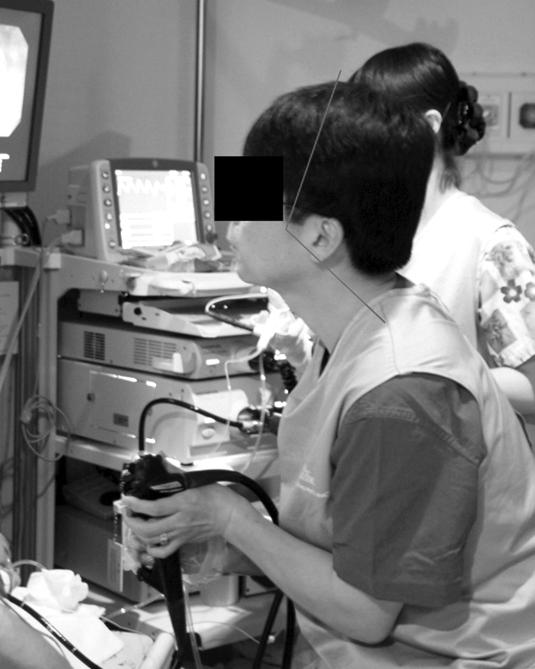 The Korean Journal of Gastrointestinal Endoscopy Room A 내시경의사의근골격계문제 : 인체공학적분석 연세대학교보건과학대학물리치료학과 Musculoskeletal Problems in Endoscopist: Ergonomic Perspective Jong-Hyuck Weon Department of Physical