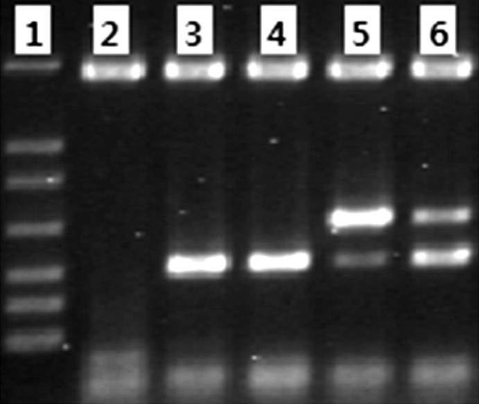 42 Korean J Clin Microbiol 2010;13(1):40-46 Chicago, IL, USA) 를사용하여비연속변수간의비교를위해카이제곱검정을이용하였다. P value가 0.05 이하인경우통계적으로유의한것으로간주하였다. 결과 1. 폐렴군과정상인군의검사별양성률다중 PCR 검사결과폐렴군은 S. pneumoniae 가 52.