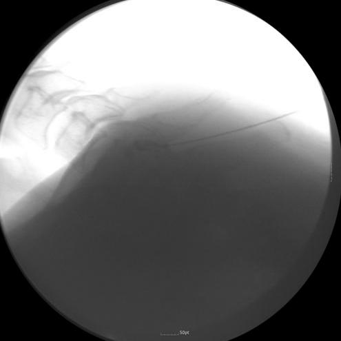 sagittal and transverse plane.