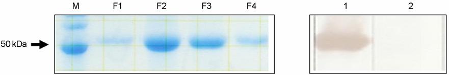 154 W-J Jeon, et al. A B C Figure 1. Immunofluorescence staining of IBDV VP2 protein expression.