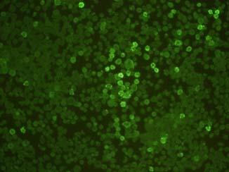 (C). A B Figure 2. Analysis of purified IBDV VP2 protein expressed from Sf9 cells by recombinant baculovirus (Bac/IBDVP2).