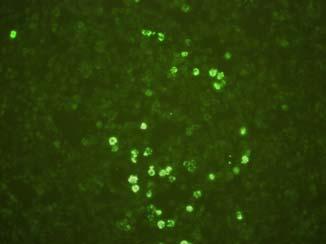 IBDV VP2-specific monoclonal antibody R63 (lane 1) and VP3-specific monoclonal antibody B29 (lane 2). IBDV VP2 단백질인것으로판단된다.