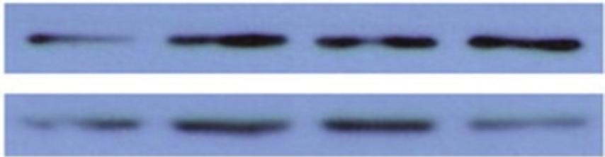 5) 사후검증결과, ApoEε4 발현은트레 드밀운동집단이 Sopolmine 투여통제집단보다유의하게감소하였 다 (p <.5) (Fig. 6). 논의 Fig. 5. Comprison of β-myloid expression on detrining in sopolmineindued memory impirment rts.