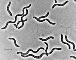 Microbiol. 2008. 67(1):63-77. Kwa et al. Mutation~ B.