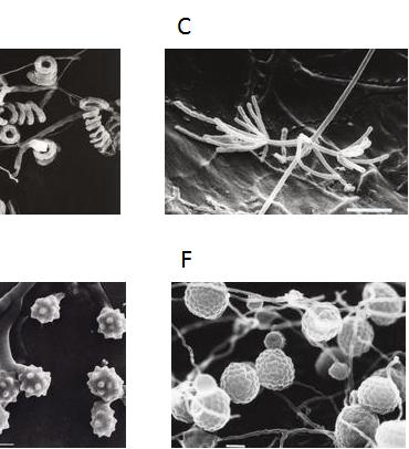 cinnamoneus의다발형포자사슬 ; D, Streptomyces viridochromogenes의고리형포자사슬및가시있는포자표면 ; E, Micromonospora