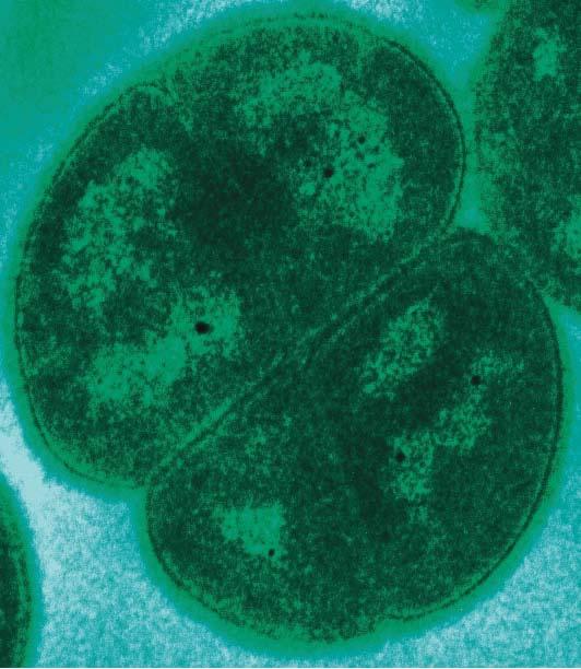 [ 그림 15-39. 네개의세포가뭉쳐존재하는 Deinococcus radiodurans] 출처 : wikipedia, TEM of D.