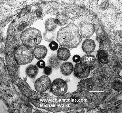 The chlamydial developmental cycle. In: Microbiology of Chlamydia, (Barron, A. L.