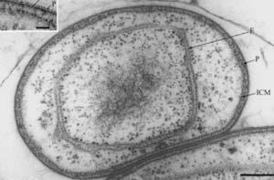 B) 유사핵막 (E), 세포막 (P), 세포내막 (ICM, intracytoplasmic membrane) 을보여주는 Gemmata