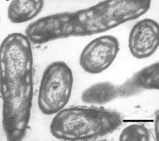 Microbiol (1991) 156 : 81 90. [ 그림 15-59.