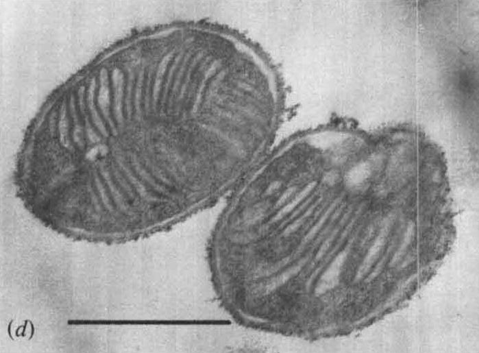 [ 그림 15-6. 메탄영양세균인 Methylosinus] 출처, J. Gen. Microbiol. 1985.