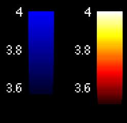 Note that significant increases of gray matter