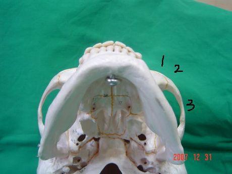 위의사진은턱아래하방에서앞광대와 45 도, 옆광대를본모습이며아래사진은수술전후에그부분을보여주는 "Arch view"