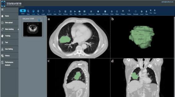 전략품목현황분석 [ 폐암 PET CT 분리및 2D, 3D 영상 ] * 출처 : http://www.etnews.