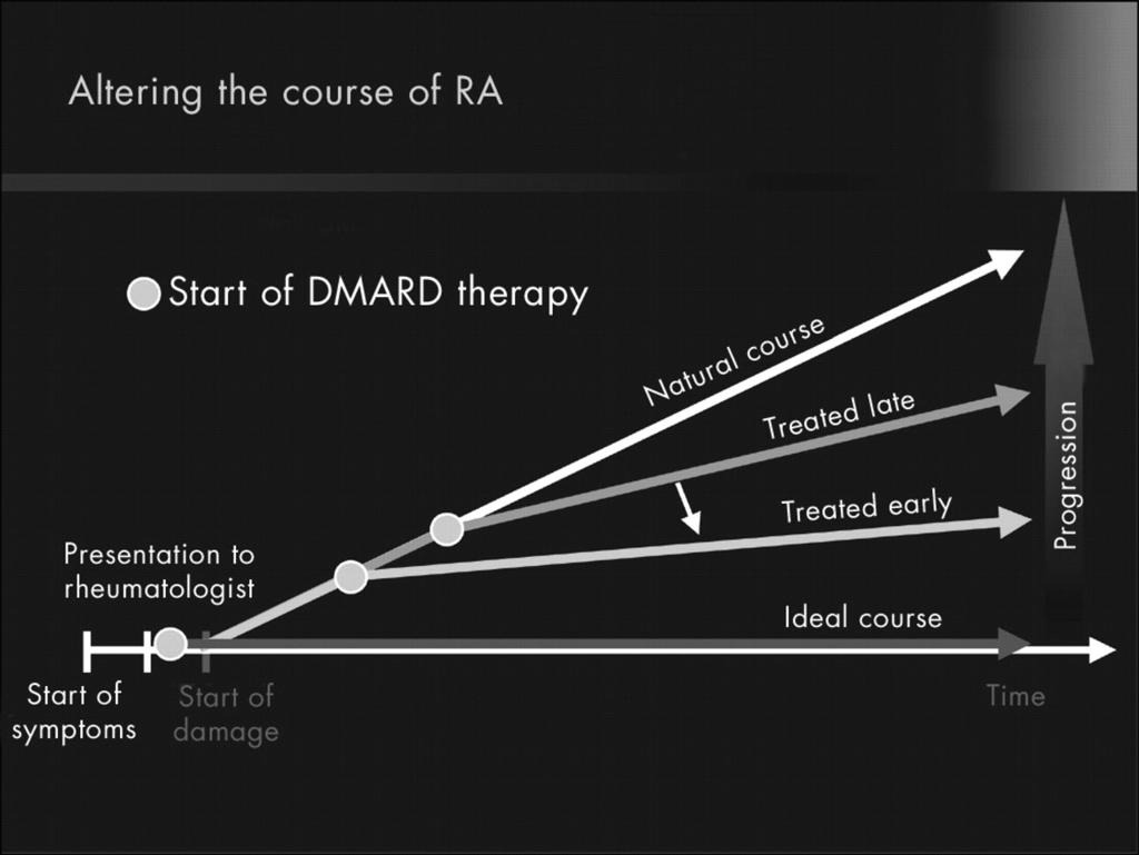 길라잡이 : 개정된가이드라인을중심으로 류마티스관절염의진행 Inflammation Disability Joint damage (X-rays) Severity (arbitrary units) 0 5 10 15 20 25 30 Duration of Disease (years) DMARDs 치료시점에따른류마티스관절염진행 류마티스관절염에서 Anti-CCP