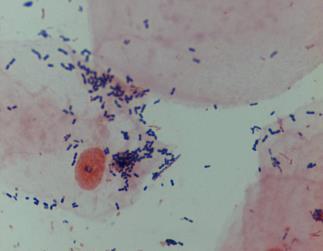직접검사법 : Microscopy and stain Gram stain