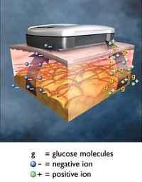 Biosensor (usually for Blood-Sugar Monitoring) Biosensor = Bioreceptor + Transducer NT + Biosensor - 안정성, 선택성, 민감성등기능강화 - 단분자분석 Nano-size Biosensor - 최소침습 (minimally invasive) Cygnus GlucoWatch