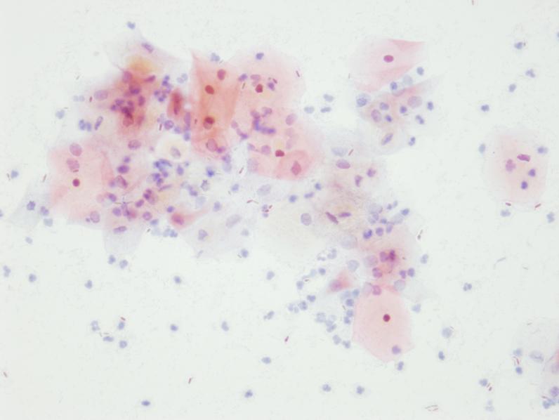 (C), and mixed infection (D).