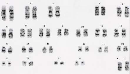(Figure 1C, D), (Figure 5A, B) Mitomycin C (Figure 5C) - 265 - AP (Figure 3A, G) SSEA-4 (Figure 3F, L), Tra-1-60
