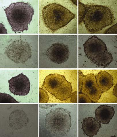 A B C D E F G H I J K L Figure 3 Immunocytochemical staining results of cell surface markers for detecting undifferentiation state of hesc grown on hafc; (A) (F) SNUhES2 P71-25 on hafc treated with