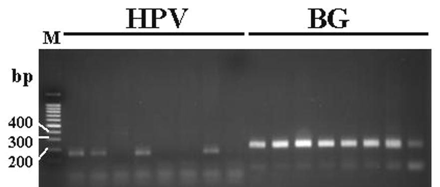 그림 4. MY09/11 HPV consensus primer 를이용하여 PCR 증폭된 HPV DNA