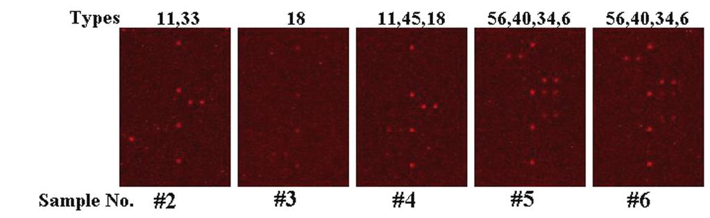 그림 6. 임상검체를이용하여 HPV DNA microarray 진단을수행한결과 단일감염일경우는 duplex spot 만발색이되며, 중복감염일경우여러가지 HPV 유전형의 multi-spot 이발색된다. (1) 시료준비 :HPV DNA 분리는상용화된제품 (Qiagen 사의 genomic DNA isolation kit) 을사용한다.