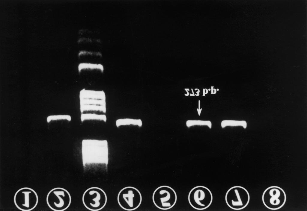 positive control (YHCC 610), 3 molecular weight marker V 4, 5, 6, 9, 10 ( ) cases 7, 8 (-) cases Fig. 2.