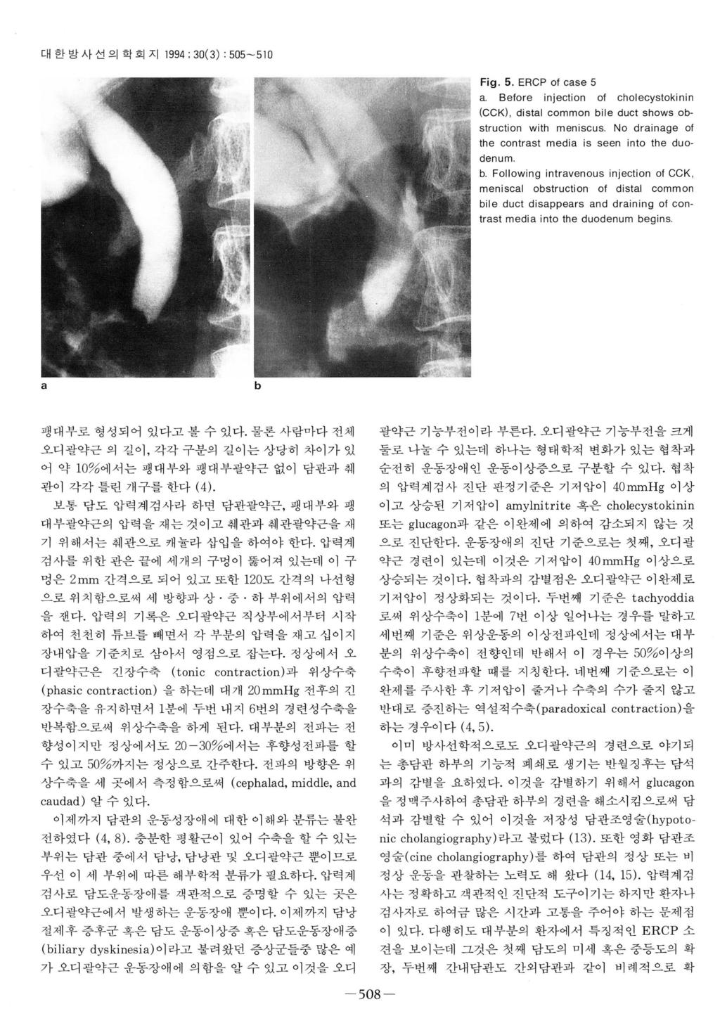 대한방사선의학회지 1994; 30(3) : 505-510 Fig. 5. ERCP of case 5 a. Before injection of cholecystokinin (CCK), distal common bile duct shows obstruction with meniscus.